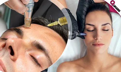 Mesotherapy + Dermapen Skin Treatment at Al Shefa Polyclinic!